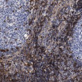 Anti-IFITM1 antibody produced in rabbit Prestige Antibodies® Powered by Atlas Antibodies, affinity isolated antibody, buffered aqueous glycerol solution