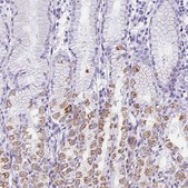 Anti-AQP6 antibody produced in rabbit Prestige Antibodies® Powered by Atlas Antibodies, affinity isolated antibody, buffered aqueous glycerol solution