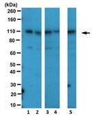 Anti-E6AP Antibody serum, from rabbit