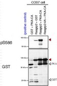 Anti-phospho RasGRP2 (Ser586) from rabbit