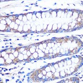Anti- FGF2 antibody produced in rabbit