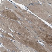 Anti-SVIL antibody produced in rabbit Prestige Antibodies® Powered by Atlas Antibodies, affinity isolated antibody, buffered aqueous glycerol solution, Ab2