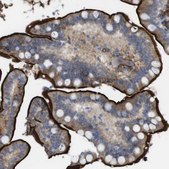 Anti-CYBRD1 antibody produced in rabbit Prestige Antibodies® Powered by Atlas Antibodies, affinity isolated antibody, buffered aqueous glycerol solution