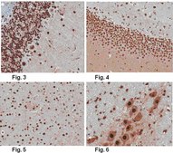 Anti-Brn-2 (POU3F2) Antibody, clone 8C4.2 clone 8C4.2, from mouse