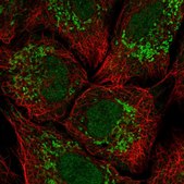 Anti-KCNH3 antibody produced in rabbit Prestige Antibodies® Powered by Atlas Antibodies, affinity isolated antibody, buffered aqueous glycerol solution