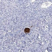 Anti-SMS antibody produced in rabbit Prestige Antibodies® Powered by Atlas Antibodies, affinity isolated antibody, buffered aqueous glycerol solution, ab1