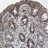 ANTI-HSPA9 antibody produced in rabbit Prestige Antibodies® Powered by Atlas Antibodies, affinity isolated antibody, buffered aqueous glycerol solution