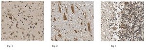 Anti-Protocadherin 19 Antibody from rabbit, purified by affinity chromatography