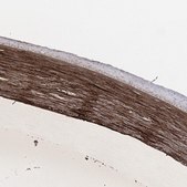 Anti-TGFBI antibody produced in rabbit Prestige Antibodies® Powered by Atlas Antibodies, affinity isolated antibody, buffered aqueous glycerol solution