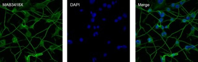 Anti-MAP2 Antibody, Alexa Fluor&#8482; 488 conjugated clone AP20, Chemicon&#174;, from mouse