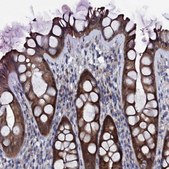 Anti-BCL2L14 antibody produced in rabbit Prestige Antibodies® Powered by Atlas Antibodies, affinity isolated antibody, buffered aqueous glycerol solution