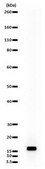Anti-phospho (Ser10)-acetyl (Lys14)-Histone H3 Antibody Upstate®, from rabbit
