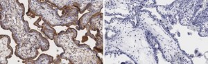 Anti-Integrin α-5 Antibody, clone 5E18 ZooMAb® Rabbit Monoclonal recombinant, expressed in HEK 293 cells
