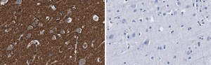 Anti-α-synuclein Antibody, clone 1D22 ZooMAb® Rabbit Monoclonal recombinant, expressed in HEK 293 cells