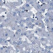 Anti-GSTP1 antibody produced in rabbit Prestige Antibodies® Powered by Atlas Antibodies, affinity isolated antibody, buffered aqueous glycerol solution, Ab1
