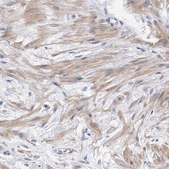 Anti-PPP5C antibody produced in rabbit Prestige Antibodies® Powered by Atlas Antibodies, affinity isolated antibody, buffered aqueous glycerol solution