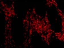 Anti-OMI (ab2) antibody produced in rabbit affinity isolated antibody, buffered aqueous solution