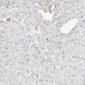 Anti-SLC25A12 antibody produced in rabbit Prestige Antibodies® Powered by Atlas Antibodies, affinity isolated antibody, buffered aqueous glycerol solution