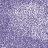 Anti-CCDC39 antibody produced in rabbit Prestige Antibodies® Powered by Atlas Antibodies, affinity isolated antibody, buffered aqueous glycerol solution