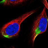 Anti-ADAMTS3 antibody produced in rabbit Prestige Antibodies® Powered by Atlas Antibodies, affinity isolated antibody, buffered aqueous glycerol solution
