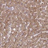 Anti-SDHD antibody produced in rabbit Prestige Antibodies® Powered by Atlas Antibodies, affinity isolated antibody, buffered aqueous glycerol solution