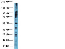 Anti-Phosphoserine Antibody Chemicon®, from rabbit