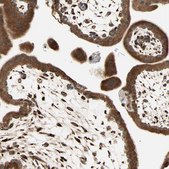 Anti-P4HA1 antibody produced in rabbit Prestige Antibodies® Powered by Atlas Antibodies, affinity isolated antibody, buffered aqueous glycerol solution