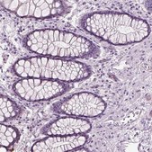 Anti-SLC1A7 antibody produced in rabbit Prestige Antibodies® Powered by Atlas Antibodies, affinity isolated antibody, buffered aqueous glycerol solution
