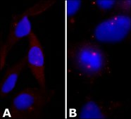 Anti-γ-Tubulin antibody produced in rabbit IgG fraction of antiserum, buffered aqueous solution
