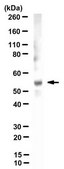 Anti-MMP-11 (Stromelysin-3) Antibody, clone 5ST-4A9 clone 5ST-4A9, from mouse