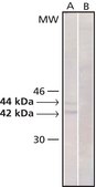 Monoclonal Anti-MAP Kinase, Activated (Diphosphorylated ERK-1&amp;2) antibody produced in mouse clone MAPK-YT, ascites fluid