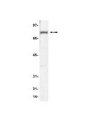 Anti-MeCP2 Antibody Upstate®, from rabbit