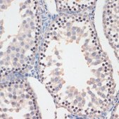 Anti-Phospho-GSK3B-S9 antibody produced in rabbit
