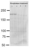 Anti-phospho Brd4 (Ser492/Ser494) from rabbit, purified by affinity chromatography
