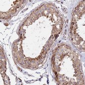 Anti-RANBP6 antibody produced in rabbit Prestige Antibodies® Powered by Atlas Antibodies, affinity isolated antibody, buffered aqueous glycerol solution