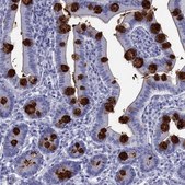 Anti-TFF3 antibody produced in rabbit Prestige Antibodies® Powered by Atlas Antibodies, affinity isolated antibody, buffered aqueous glycerol solution