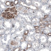 Anti-MYO1B antibody produced in rabbit Prestige Antibodies® Powered by Atlas Antibodies, affinity isolated antibody, buffered aqueous glycerol solution