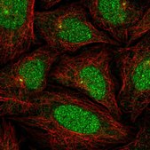 Anti-KLHL35 antibody produced in rabbit Prestige Antibodies® Powered by Atlas Antibodies, affinity isolated antibody, buffered aqueous glycerol solution