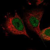 Anti-SH3BP2 antibody produced in rabbit Prestige Antibodies® Powered by Atlas Antibodies, affinity isolated antibody, buffered aqueous glycerol solution