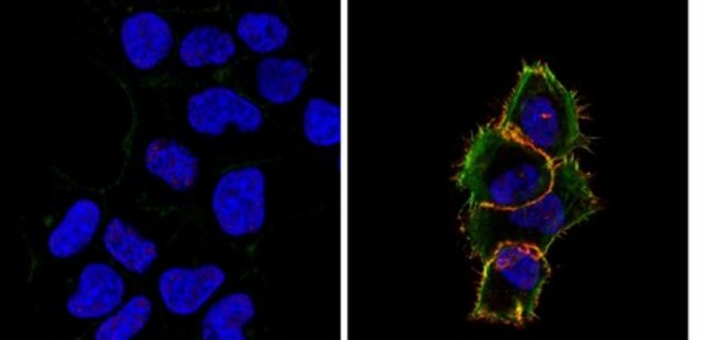Anti-phospho-EGFR (Tyr1173) Antibody, clone 3E7.2 clone 3E7.2, from mouse