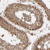 Anti-PNCK antibody produced in rabbit Prestige Antibodies® Powered by Atlas Antibodies, affinity isolated antibody, buffered aqueous glycerol solution