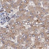 Anti-TOLLIP antibody produced in rabbit Prestige Antibodies® Powered by Atlas Antibodies, affinity isolated antibody, buffered aqueous glycerol solution