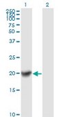 Monoclonal Anti-COMMD1 antibody produced in mouse clone 2A12, purified immunoglobulin, buffered aqueous solution