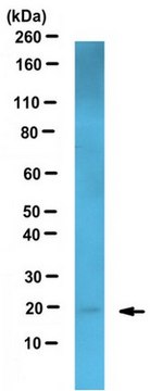 Anti-PLGF Antibody, clone 216-17 clone 216-17, from mouse