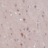 Anti-ARHGEF25 antibody produced in rabbit Prestige Antibodies® Powered by Atlas Antibodies, affinity isolated antibody, buffered aqueous glycerol solution