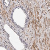 Anti-MRPS10 antibody produced in rabbit Prestige Antibodies® Powered by Atlas Antibodies, affinity isolated antibody, buffered aqueous glycerol solution, ab1
