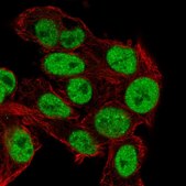 Anti-TRIM24 antibody produced in rabbit Prestige Antibodies® Powered by Atlas Antibodies, affinity isolated antibody