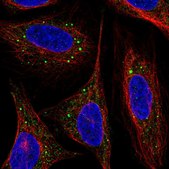 Anti-ARL4D antibody produced in rabbit Prestige Antibodies® Powered by Atlas Antibodies, affinity isolated antibody, buffered aqueous glycerol solution