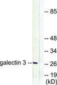 Anti-Galectin 3 antibody produced in rabbit affinity isolated antibody