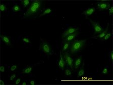 Monoclonal Anti-RPL9 antibody produced in mouse clone 2F11, purified immunoglobulin, buffered aqueous solution